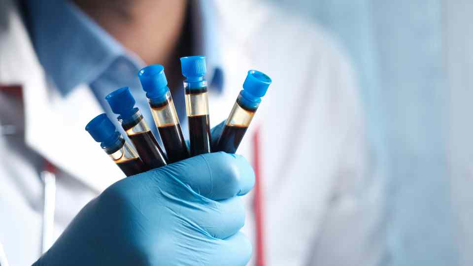 How long do blood test results take to get back for assessment?
