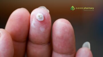 Fingertip wart