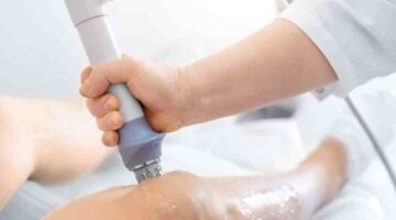 Skin tag removal near me