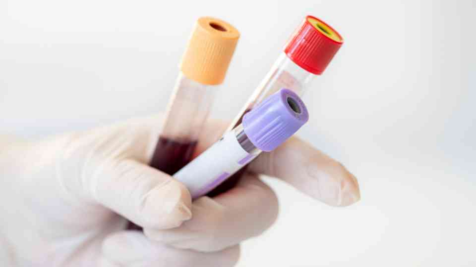 Get your blood test results