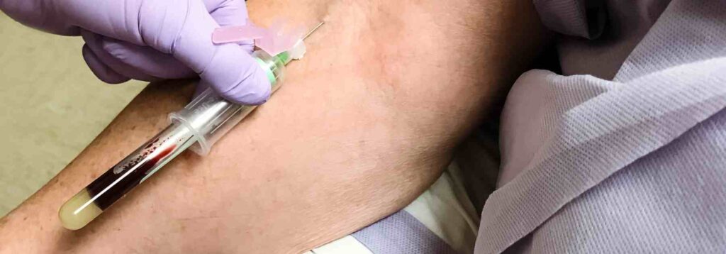 What does a fasting blood test test for?