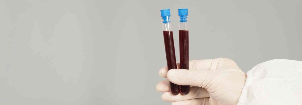 Blood test tubes